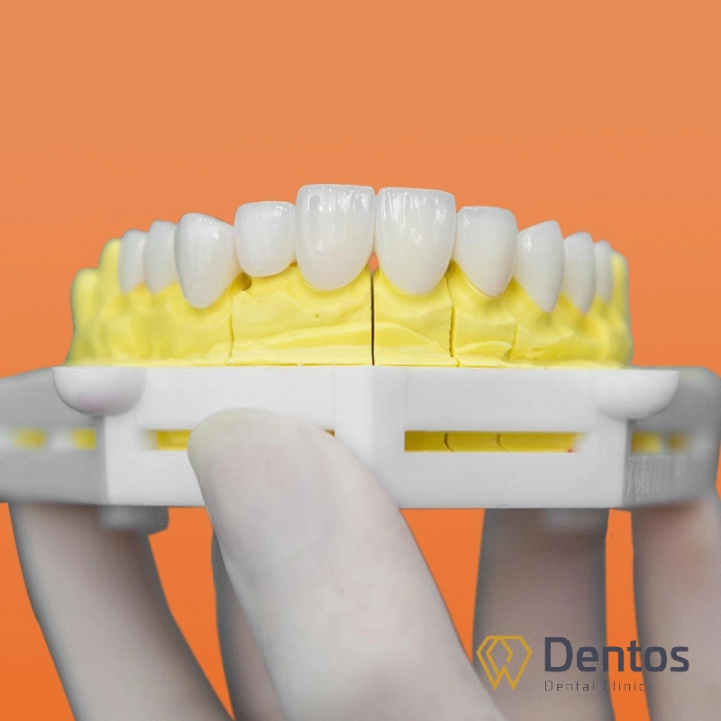 Răng toàn sứ được chế tác hoàn toàn từ 100% vật liệu sứ nha khoa cao cấp